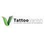 Tattoo Vanish